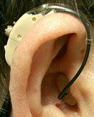 Bluetooth Hearing Aid