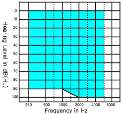 Digital hearing aid fitting